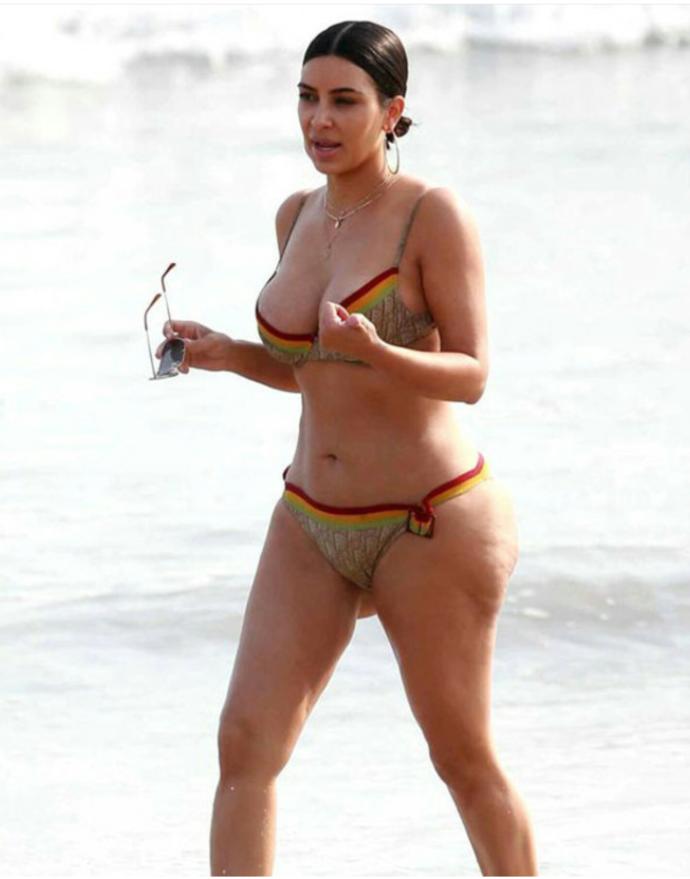 Kardashian'ın selülitleri sosyal medyayı salladı! Selülit denen kusur güzel bir kadını bile itici gösterme potansiyeline sahip mi?
