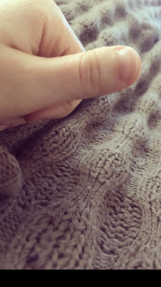 Sizce baş parmaklarım çok mu tuhaf?