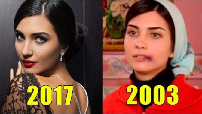 Tuba Büyüküstün'de estetik varmış?