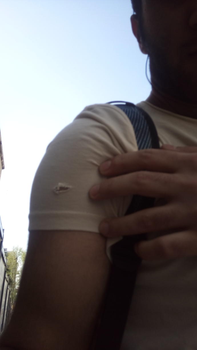 T-shirtüm yırtıldı ne yapabilirim?