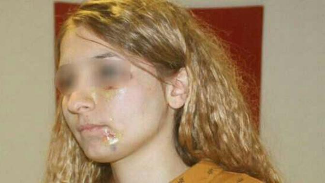 Mardin’de kadın polis, saçını yaptırdığı kuaför tarafından darp edildi. Bir polise yapılan bu muameleye sizin tepkiniz ne olurdu?