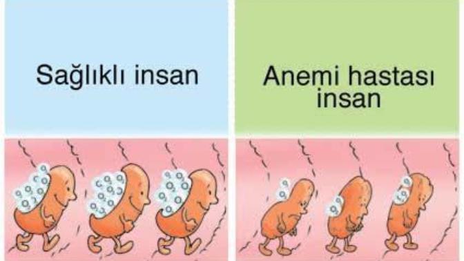 Anemi/kansızlık sorunu olan var mı? Kansızlığa iyi gelen yiyecekler nelerdir?