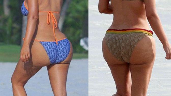 Kim Kardashian'ın kalçasına bir günde ne oldu?