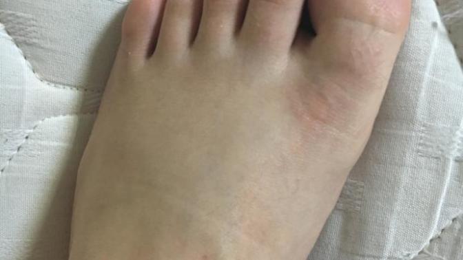 Ayak tırnaklarım çok kötü nasıl düzelir bunlar?