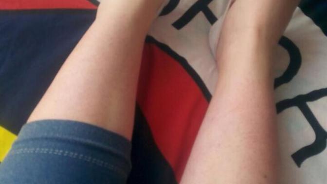 Nasıl geçer bu kırmızı noktalar?