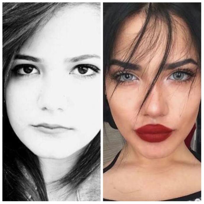 Instagram kızlarının estetik öncesi ve sonrası halleri hakkında ne