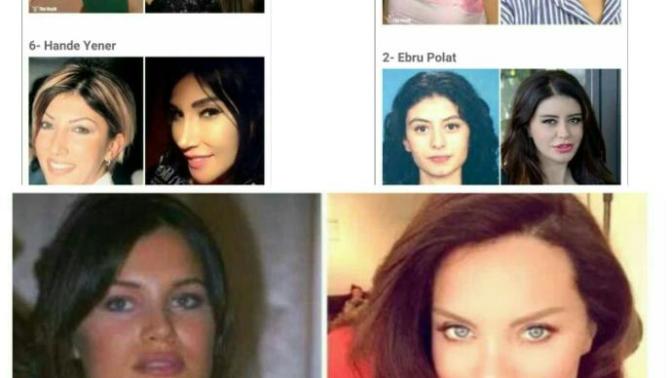 Estetik guzellerinin gercek hali?