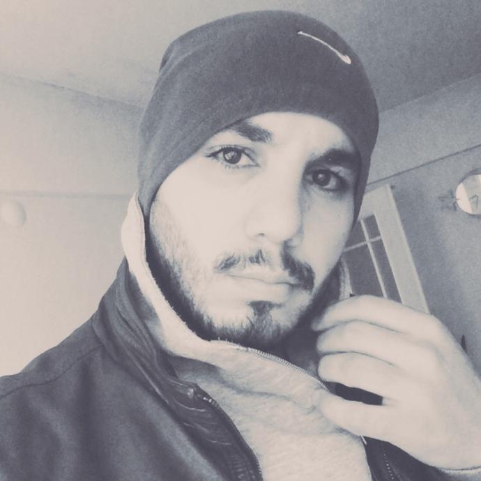 Burnuma estetik yaptırdım görüşlerinizi alayım 🙊 ?