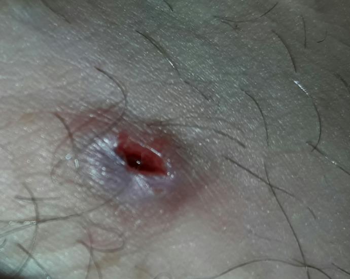 Acil hemşir hemşire doktor doçent  bir  yardımcı olabilirmi ?