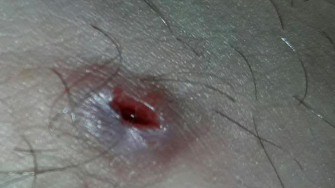 Acil hemşir hemşire doktor doçent  bir  yardımcı olabilirmi?