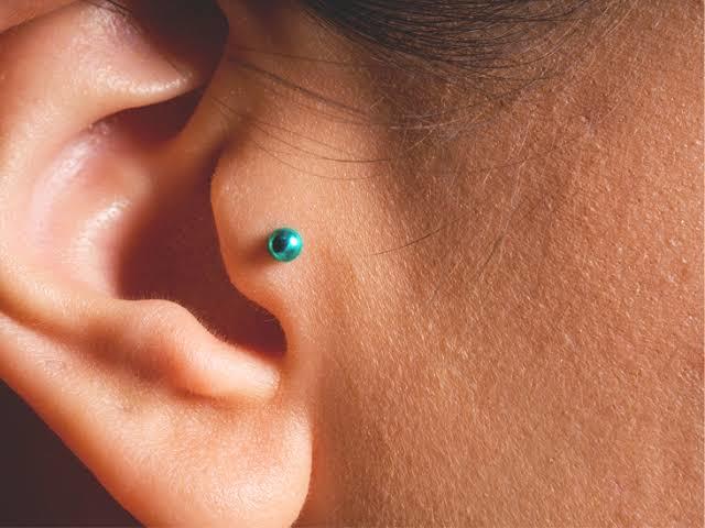 Tragus iltihap kaptı