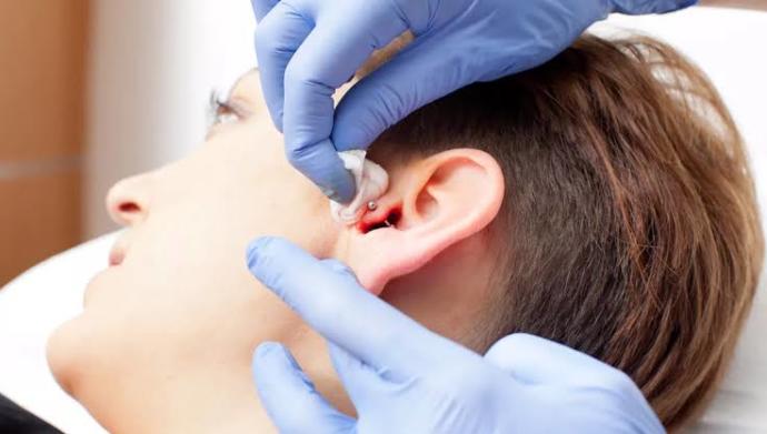 Tragus Piercing İltihabı için Krem Önerileri Nelerdir?