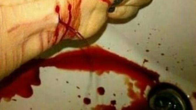 Bilekleri kesince gercekten kurtulma şansı var mı?