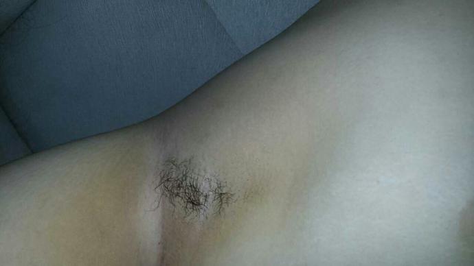 Bacak kıllarım fazla mı?