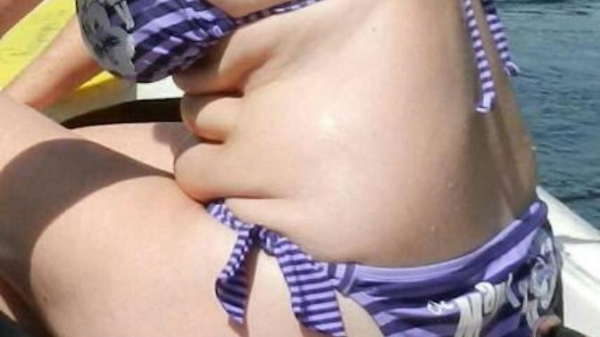 Kimler gobegim var ama bu yaz yinede bikini giyecegim diyor?