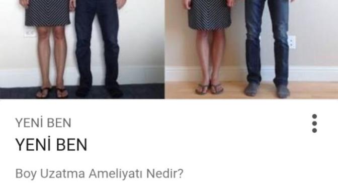 Boy uzatma ameliyatı öncesi ve sonrası?