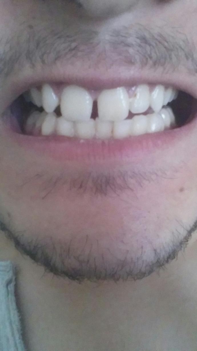 Diş yapım önerileri ve fiyatları?