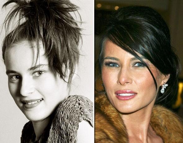 Melania Trump'ın estetiksiz hali ortaya çıktı! Sizce hangi hali daha güzel?