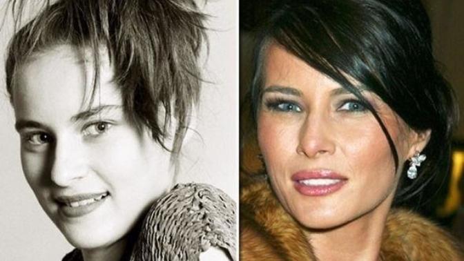 Melania Trump'ın estetiksiz hali ortaya çıktı! Sizce hangi hali daha güzel?