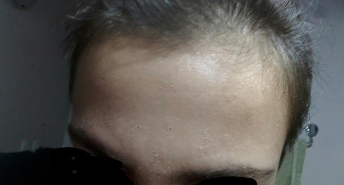 Yüzüm neden böyle oluyor? Lütfen  bir  bakar mısınız?