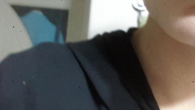 Yüzüm neden böyle oluyor? Lütfen  bir  bakar mısınız?
