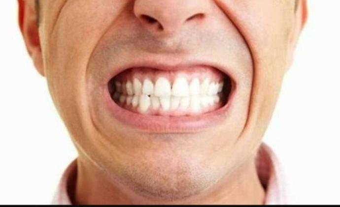 Gece ve Gündüz Dişlerimi Sıkıyorum Çözümü Olan ya da Başına Gelen??