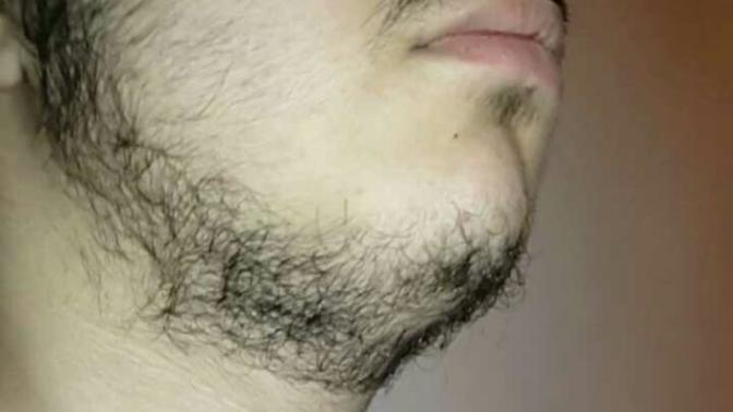 19 Yaşındayım Sakallarım Neden Gür ve Sert Değil?