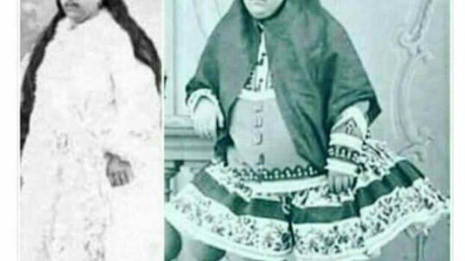 Aşkın gözü kör olabilir mi?