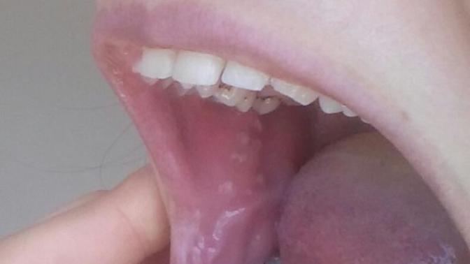 Arkadaslar bu fotoğraflarda ağzımda cıkan beyaz beyaz şeyler nedir :(?