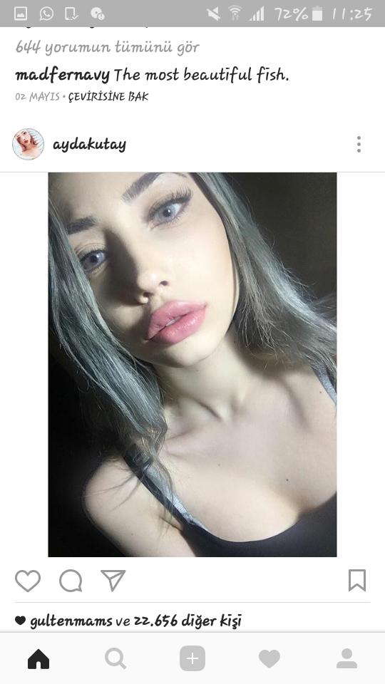 Ayda Kutay�ın Dudakları Sizce Estetik Mi? KizlarSoruyor