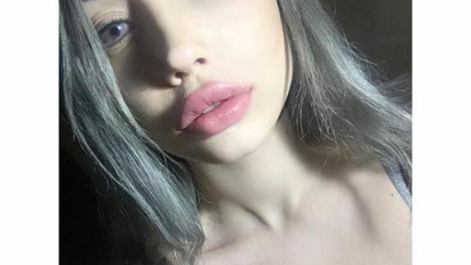 Ayda Kutay'ın Dudakları Sizce Estetik Mi?