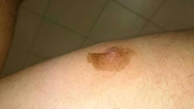 Vücudumda böyle  bir  şey çıktı. hiç oldu mu sizde?