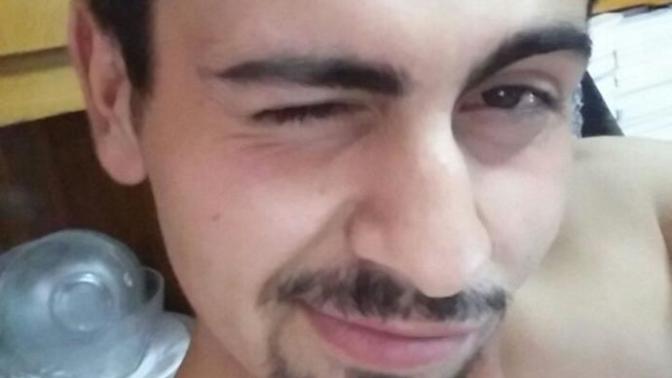 Sarımsakla sakal cıkartan var mı?