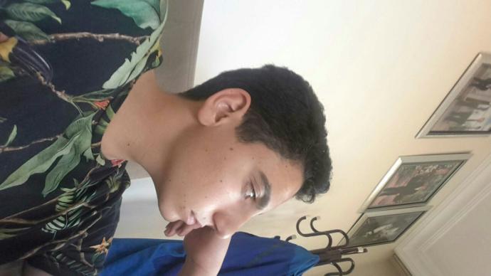 yandan görünümüm  çok kötü alnim çok geride bu nasıl düzelir sizce????