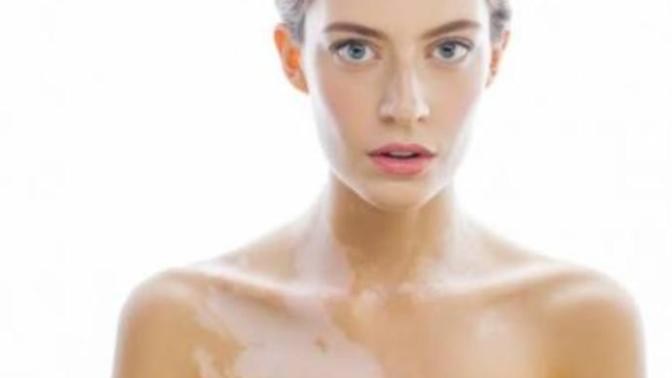 Vitiligo hastasıyım ve sizden yardım istiyorum?