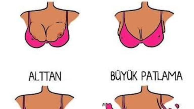 Memenin sütyenden taşma biçimleri?