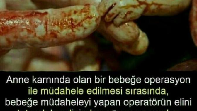 Kendinizi güvende hissettiğinizi nasıl anlıyorsunuz, bunun için ihtiyacınız olan şeyler nelerdir?