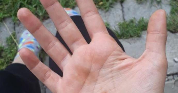 Sabah Elimde Kına Lekesi ile Uyandım! Bilimsel Açıklaması Nedir?