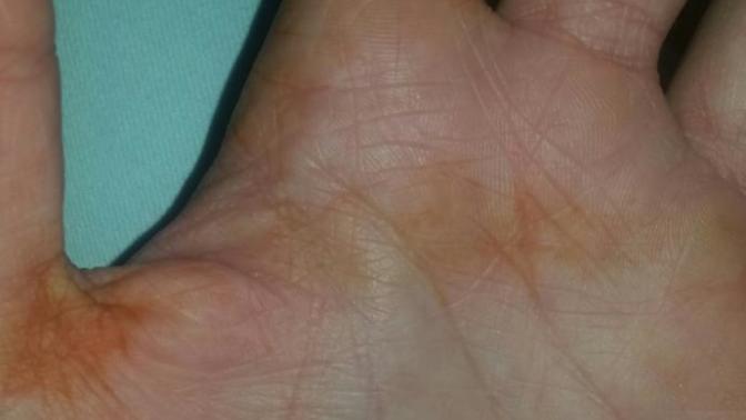 Sabah Elimde Kına Lekesi ile Uyandım! Bilimsel Açıklaması Nedir?