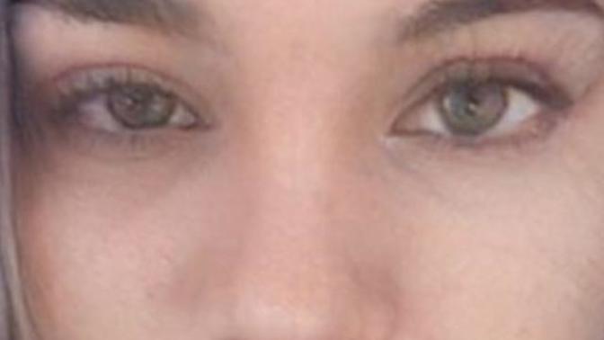 Uyandım gözüm böyle gözümün biri diğerinden büyükmü banamı öyle geliyor😐😔?