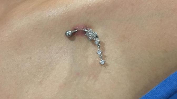 1,5 ay önce yaptırdığım piercing çok kötü duruma geldi kızarıklık oluştu ve bazen iltihap akıyor. Bunlar normal semptomlar mı?