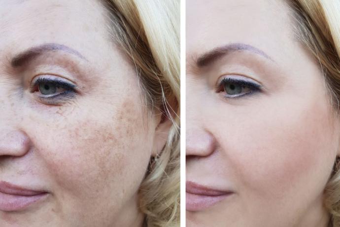 Baby Face Beauty cilt bakımı yaptıran var mı? Baby Face Beauty fiyatı ne?