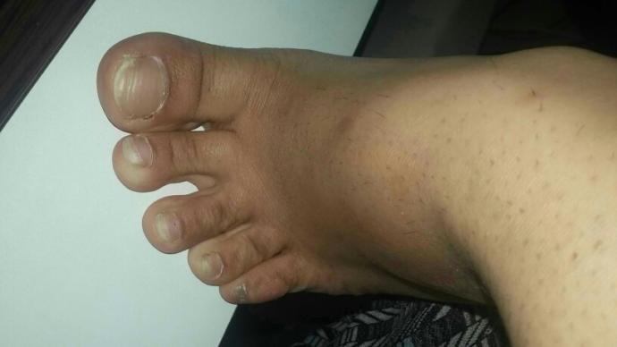 Ayak bileğine zincir olarak takan kadınlar birtek benimi etkiliyor?