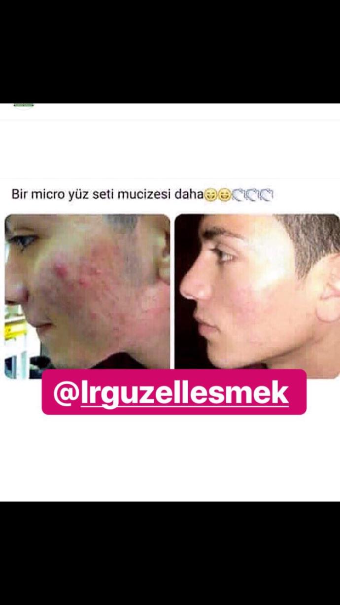 Sivilcelerinden kurtulan var mı?