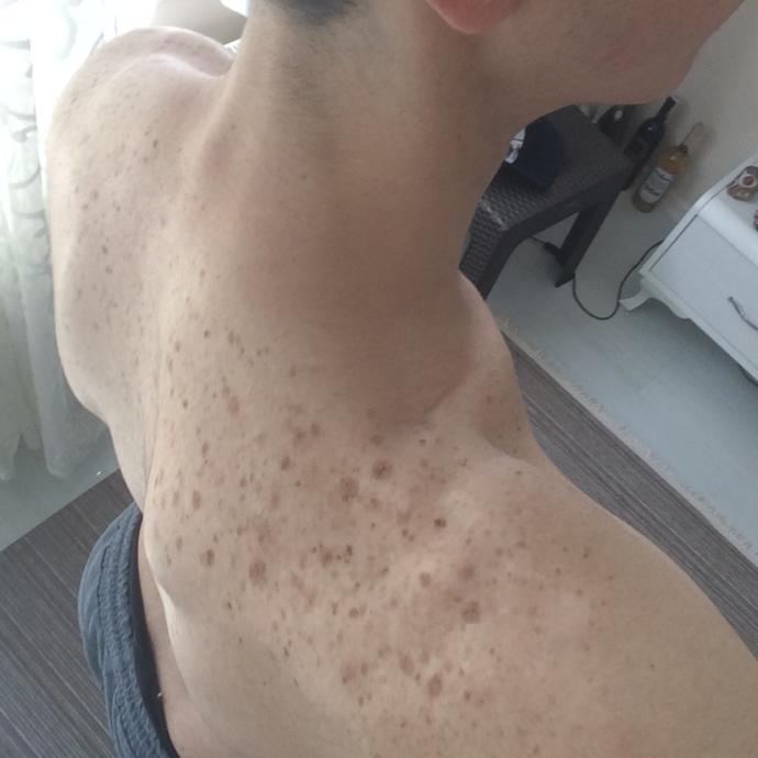 Çilleri geçiren kremler?