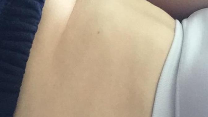 Zayıfım ama deği̇si̇k bi̇r göbeği̇m var si̇zce neden ne yapmalıyım? (sı̇zce çok mu kötü)?