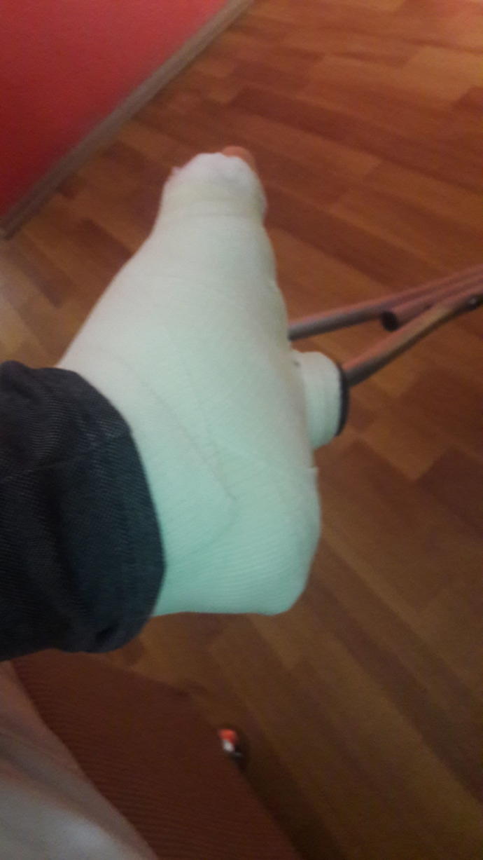 Size kaval kemiği parçalama anımı anlatıyorum , içimi döküyorum :D?