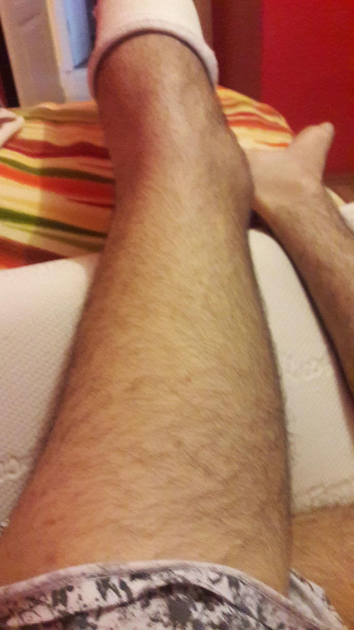 Size kaval kemiği parçalama anımı anlatıyorum , içimi döküyorum :D?