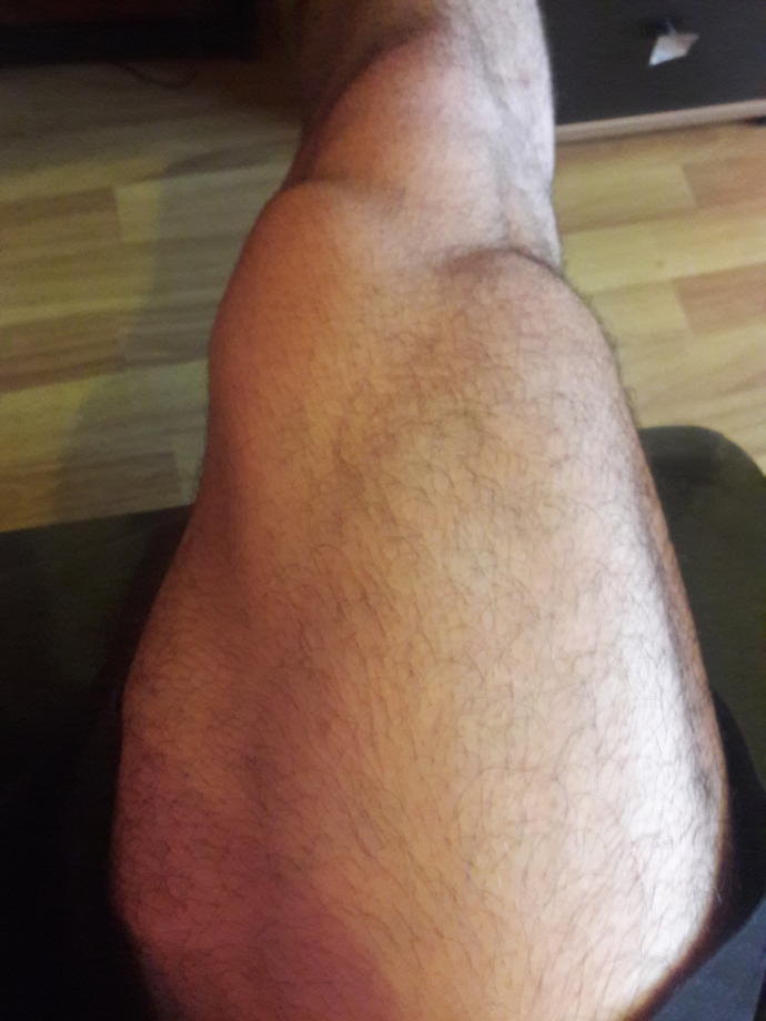 Size kaval kemiği parçalama anımı anlatıyorum , içimi döküyorum :D?