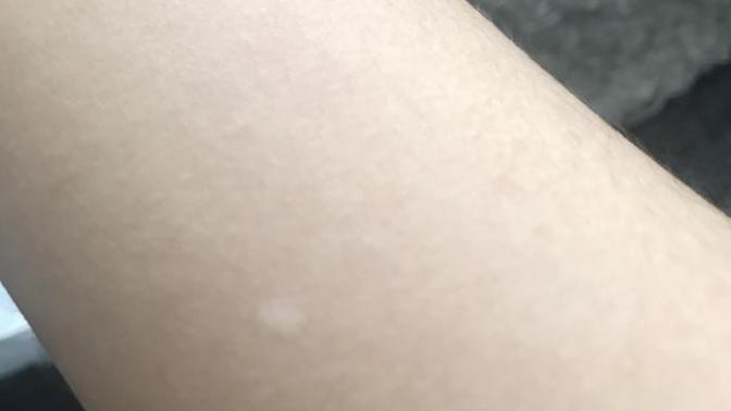Kolumdaki beyez minik leker bilgisi olan?